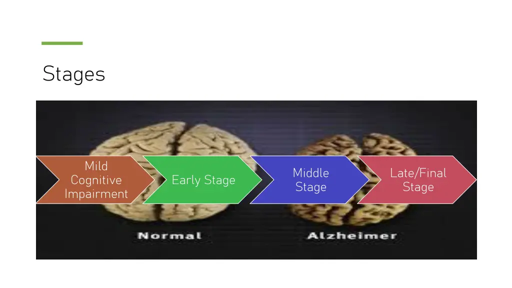 stages