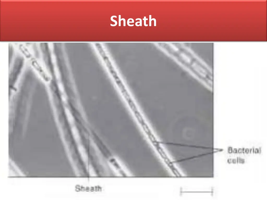 sheath
