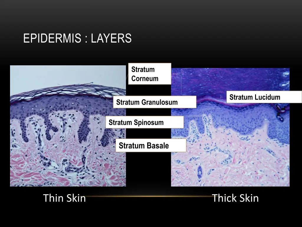 epidermis layers