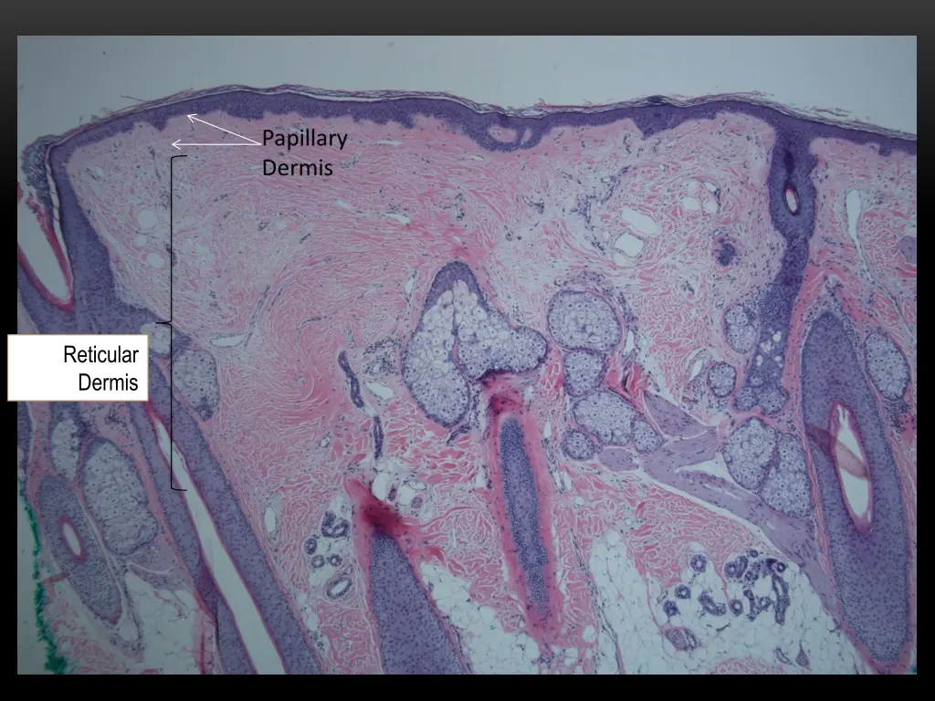 reticular dermis 1