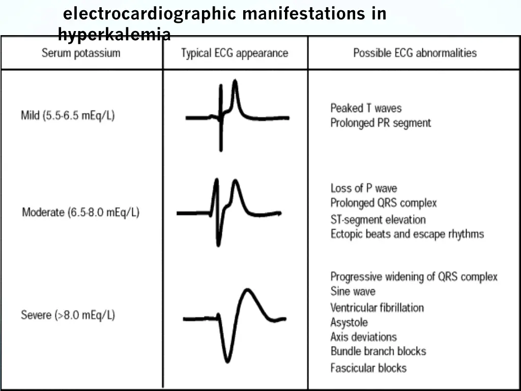 electrocardiographic manifestations