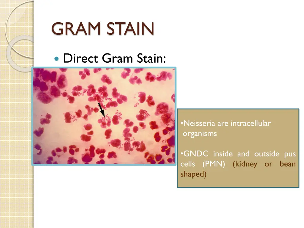 gram stain