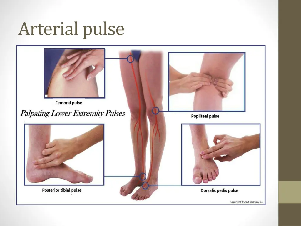 arterial pulse