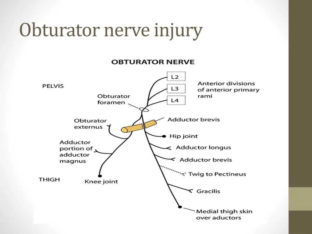 obturator nerve injury
