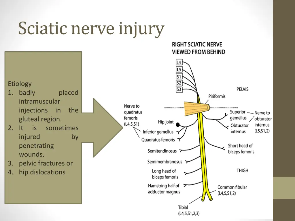 sciatic nerve injury