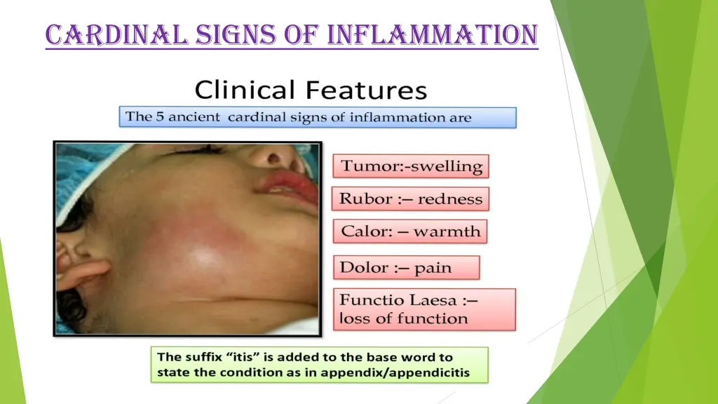 cardinal signs of inflammation