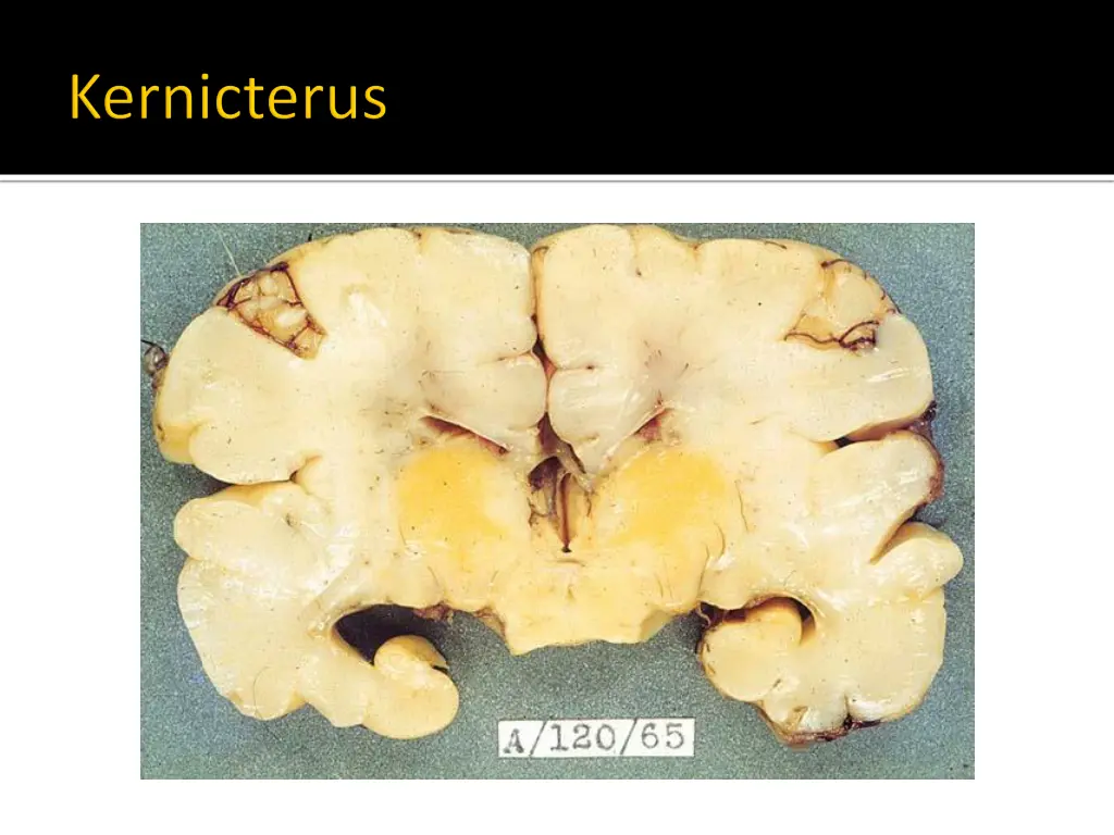 slide21