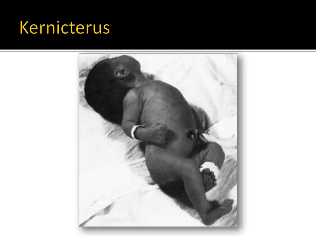 slide23