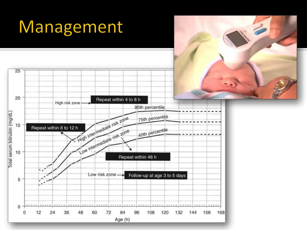 slide28