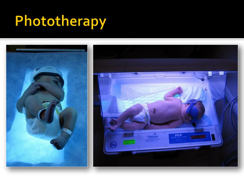 slide29