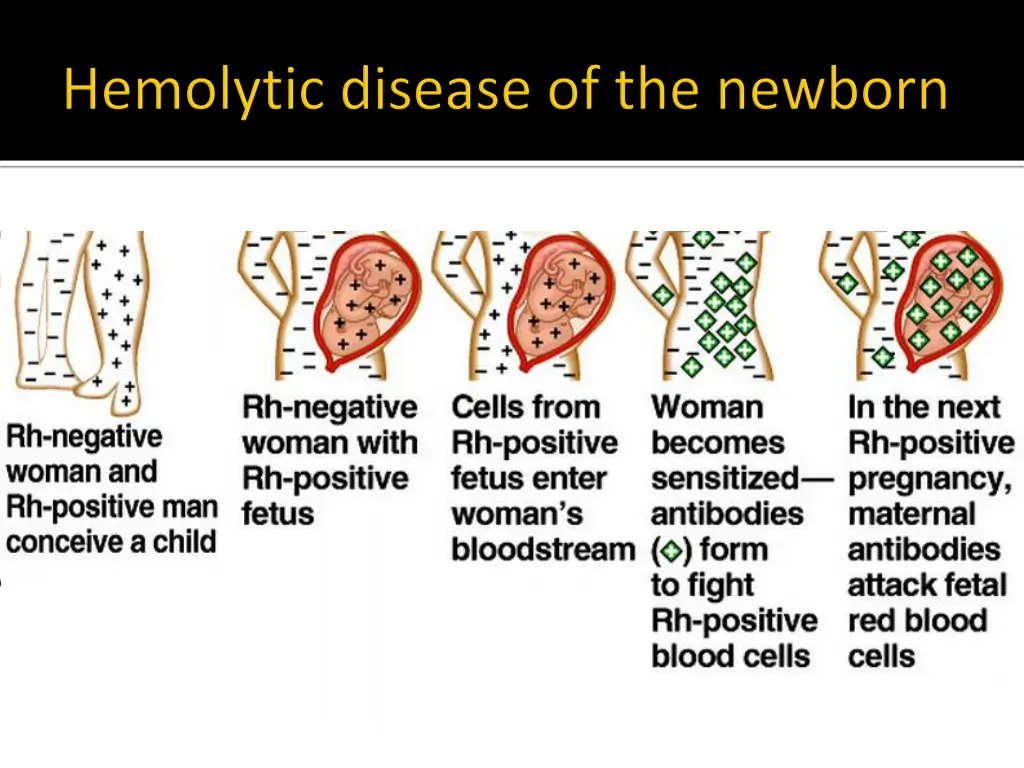 slide35