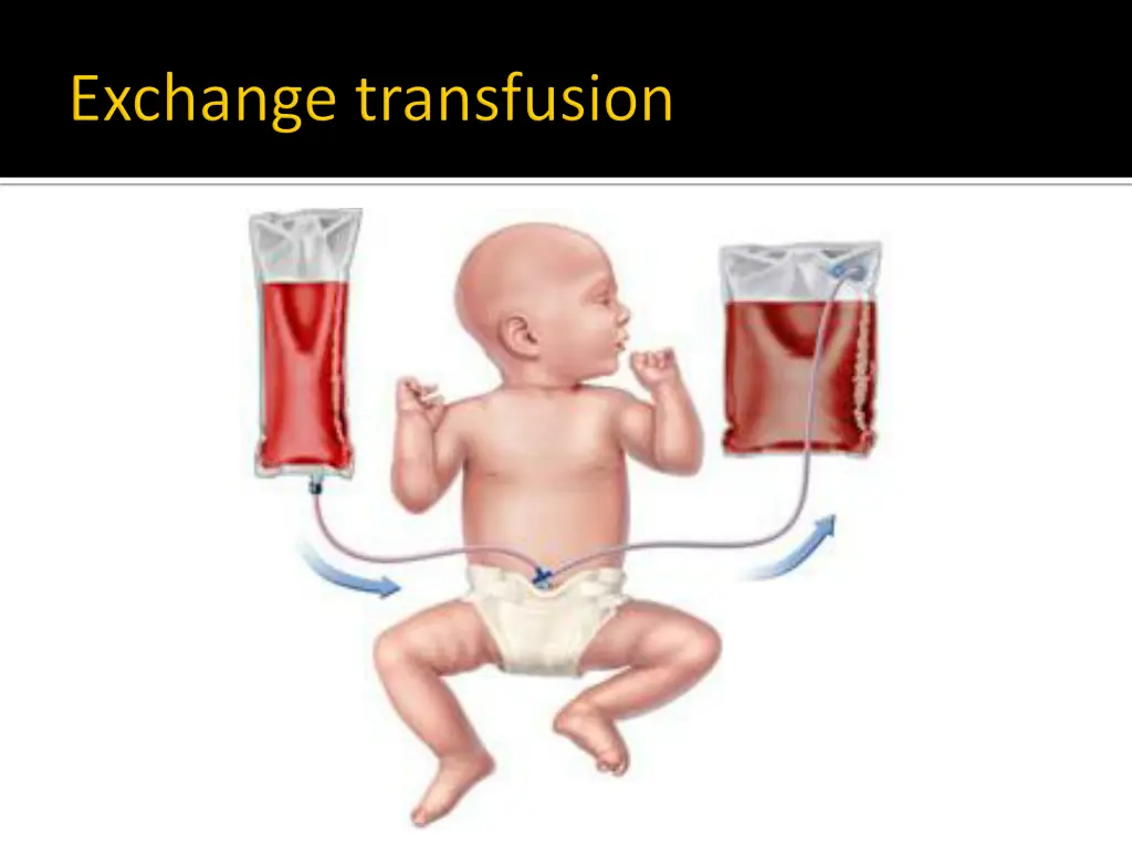 slide40