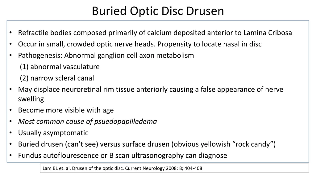buried optic disc drusen