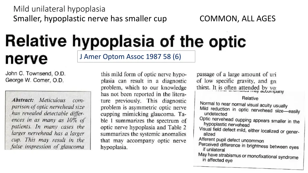mild unilateral hypoplasia smaller hypoplastic