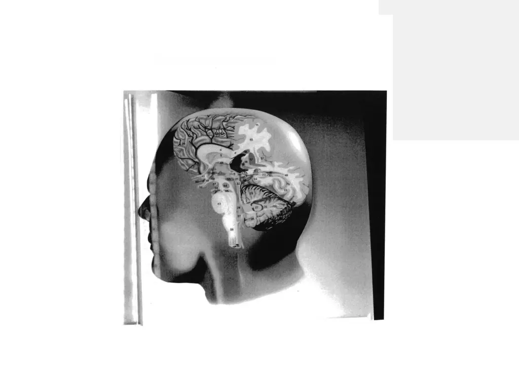 the brain of a