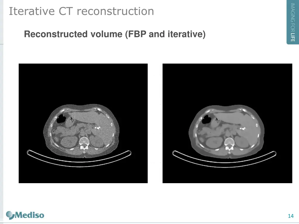 iterative ct reconstruction 4