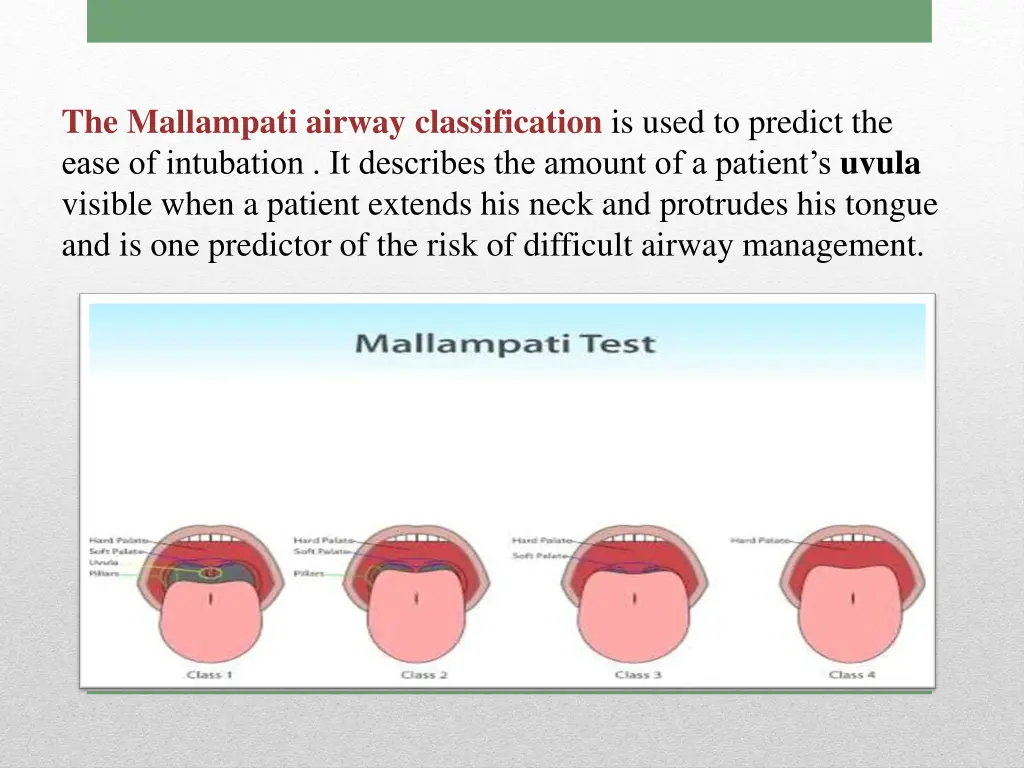 the mallampati airway classification is used