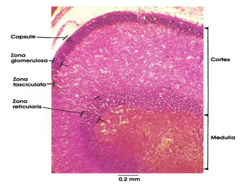 slide11
