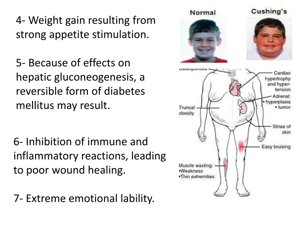4 weight gain resulting from strong appetite