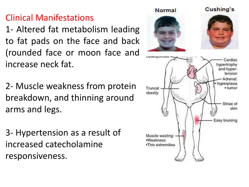 clinical manifestations 1 altered fat metabolism