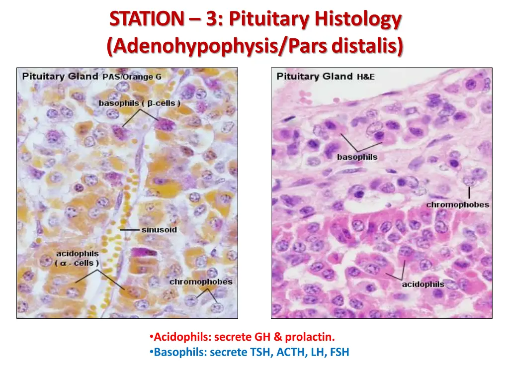 station 3 pituitary histology adenohypophysis