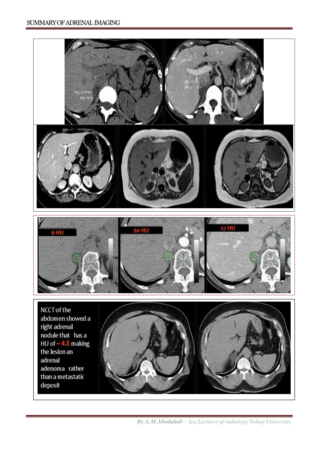 summary of adrenalimaging 2
