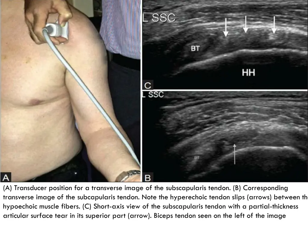 a transducer position for a transverse image