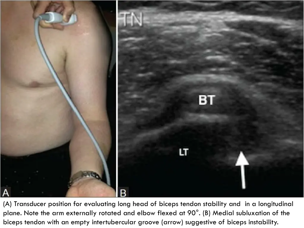 a transducer position for evaluating long head
