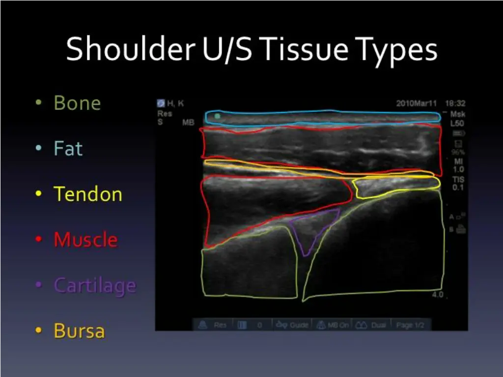 slide5