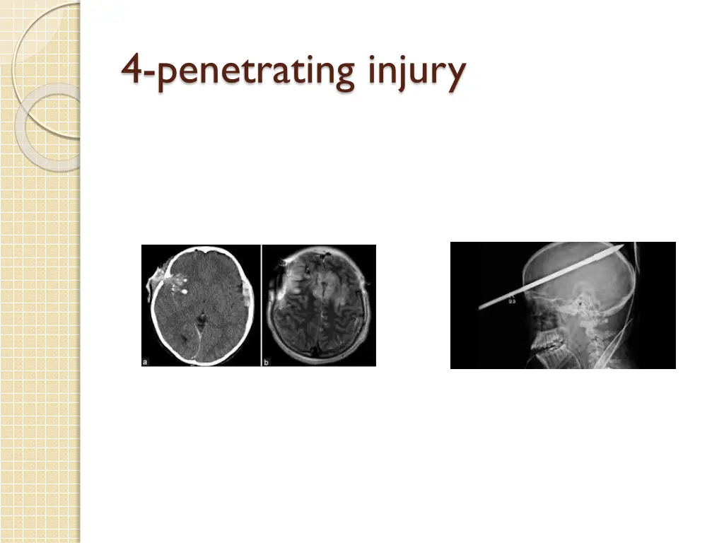 4 penetrating injury