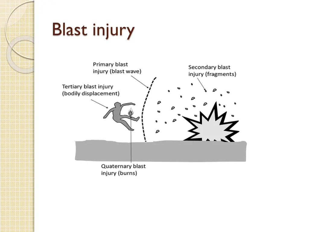 blast injury