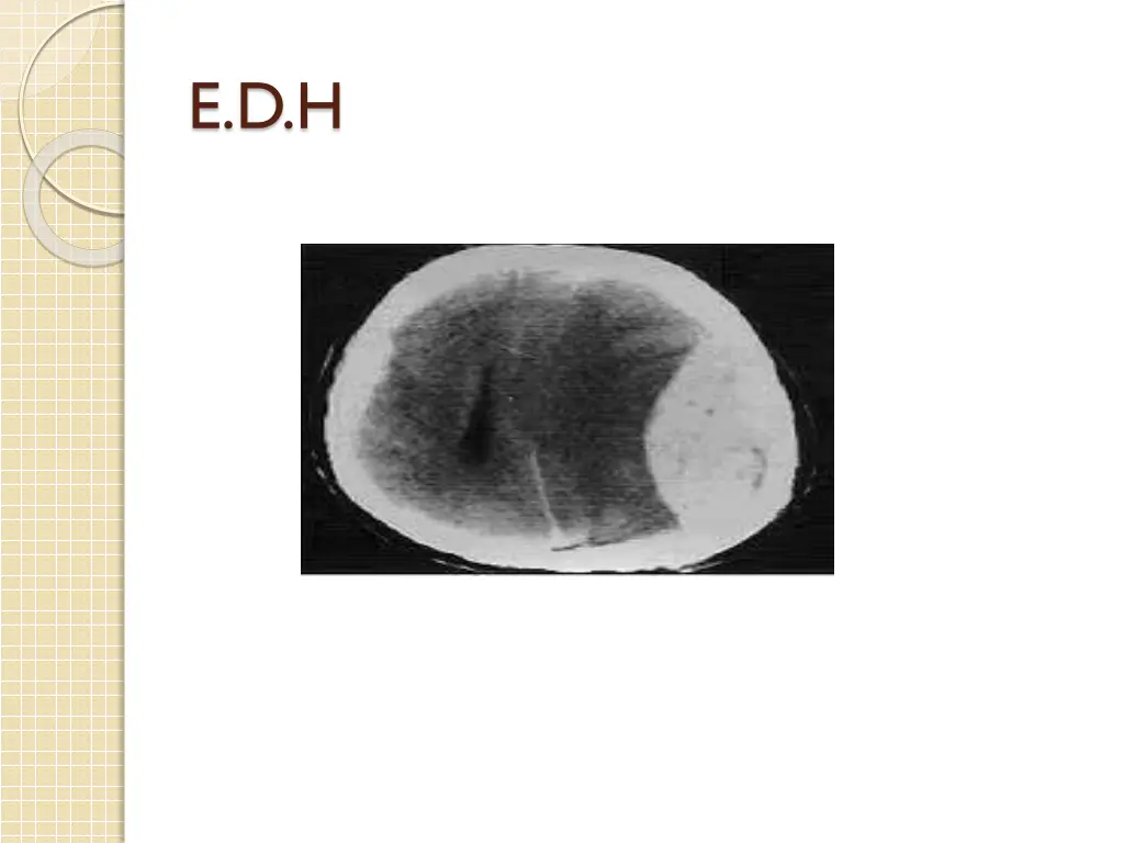e d h