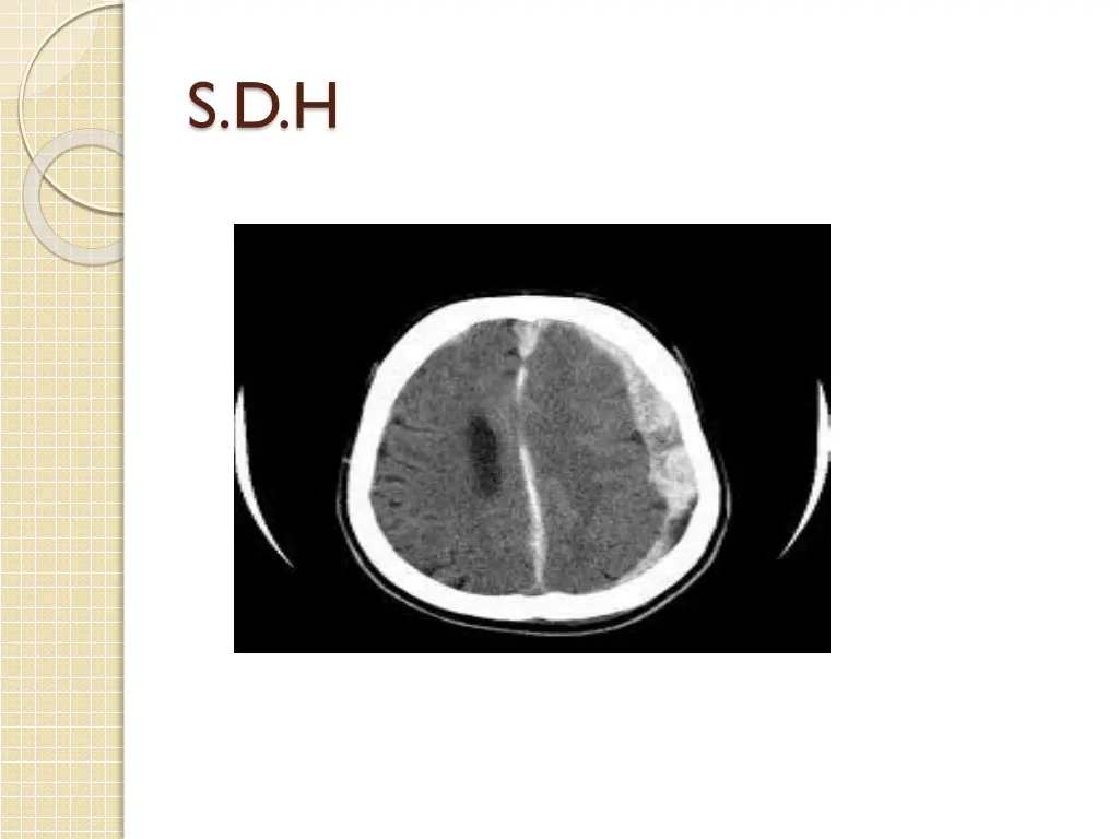 s d h