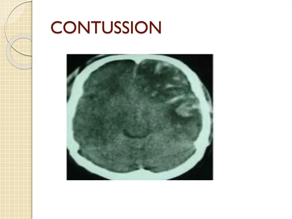 slide14