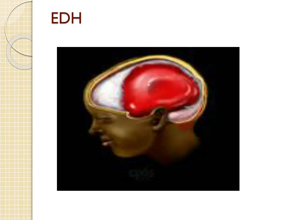 slide27
