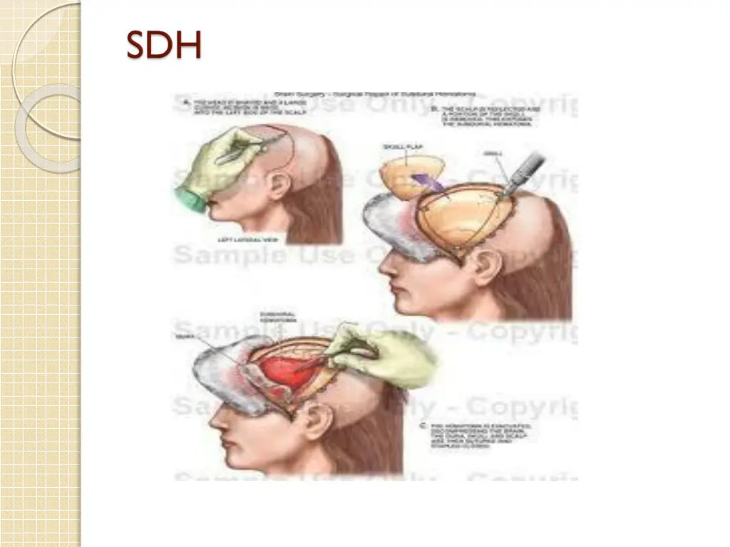 slide28