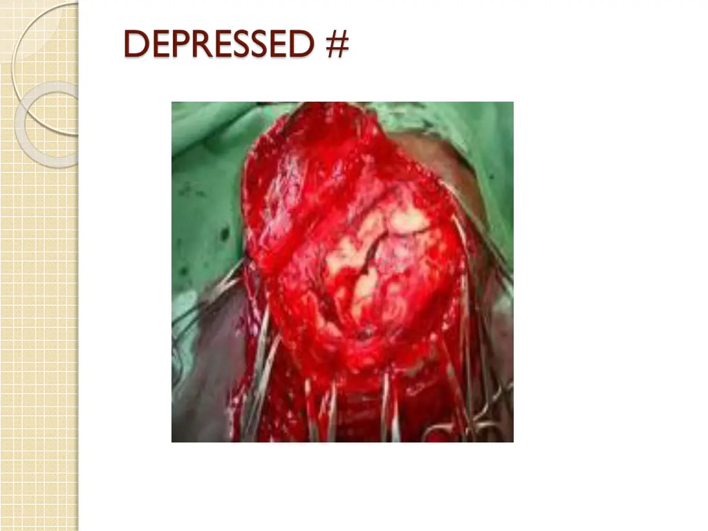 slide29