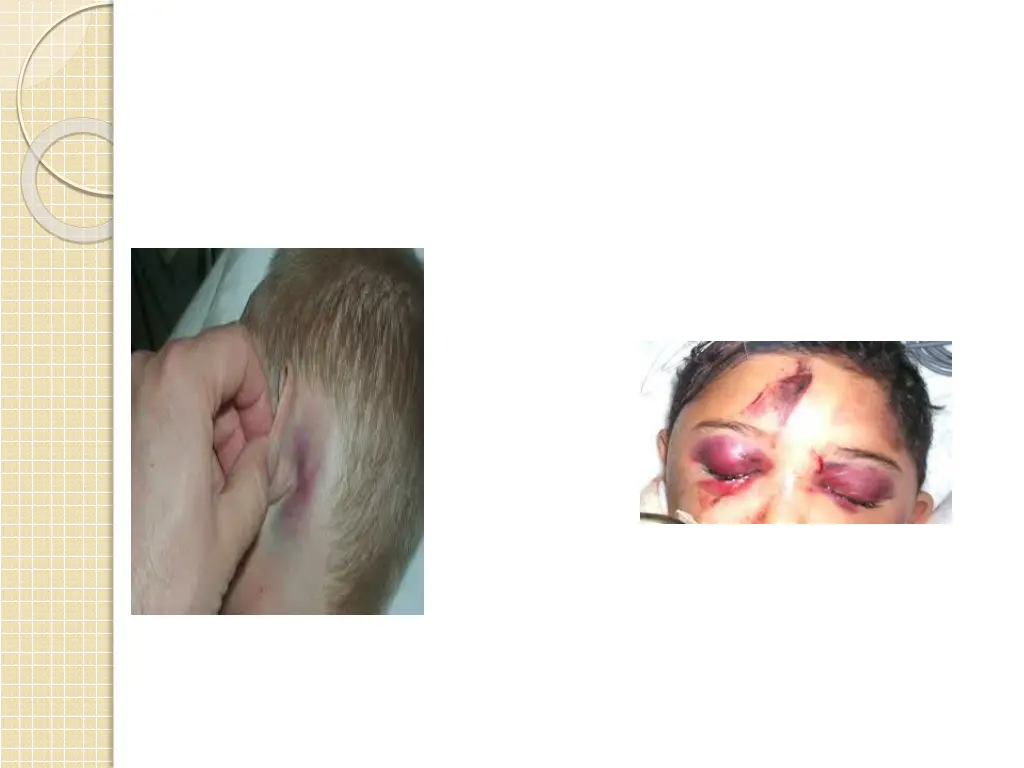 slide8