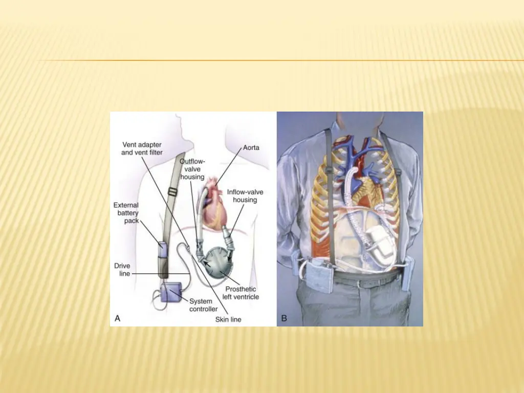 slide24
