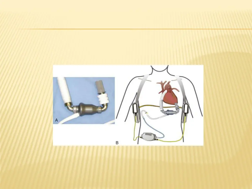 slide25