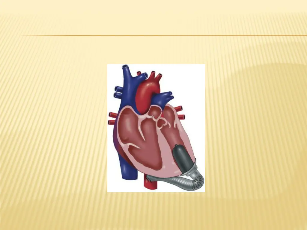 slide26