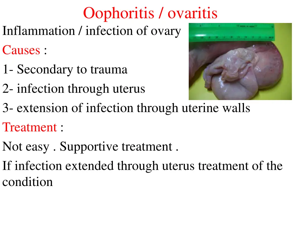 oophoritis ovaritis