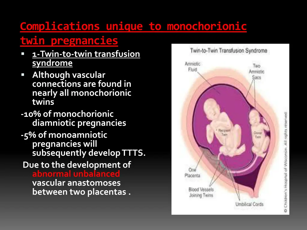 complications unique to monochorionic twin
