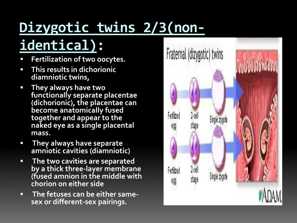 dizygotic twins 2 3 non identical fertilization