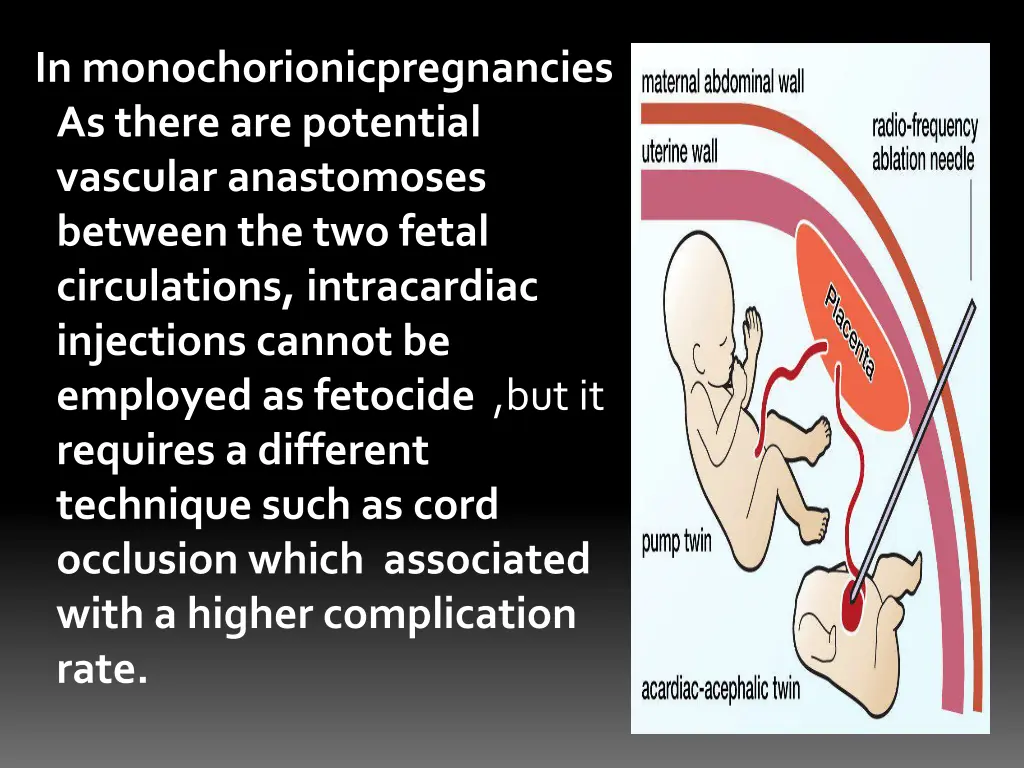 in monochorionicpregnancies as there