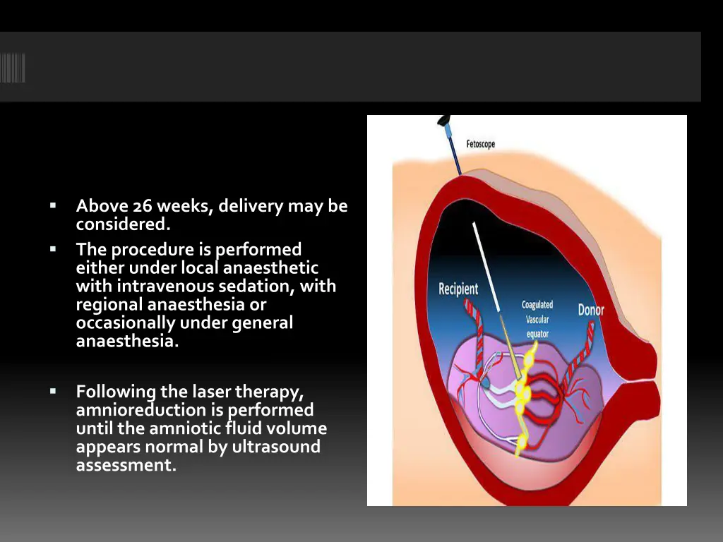 slide28