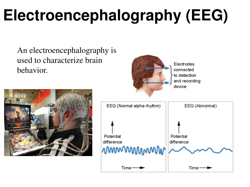 electroencephalography eeg