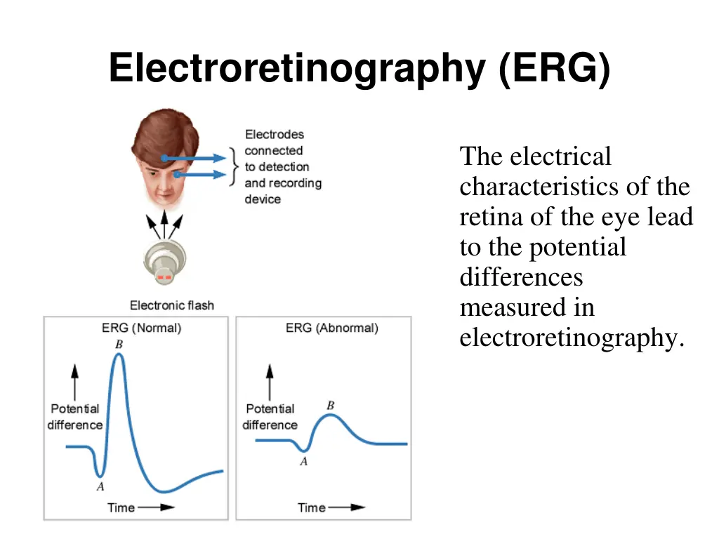 electroretinography erg