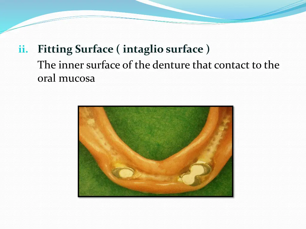 ii fitting surface intaglio surface the inner