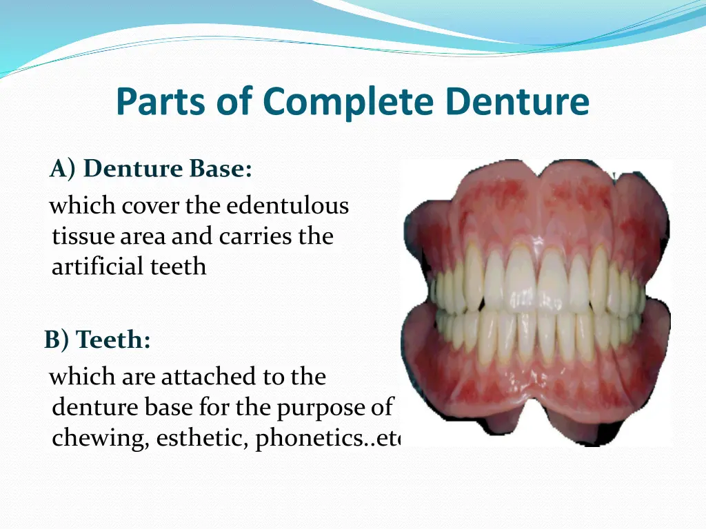 parts of complete denture